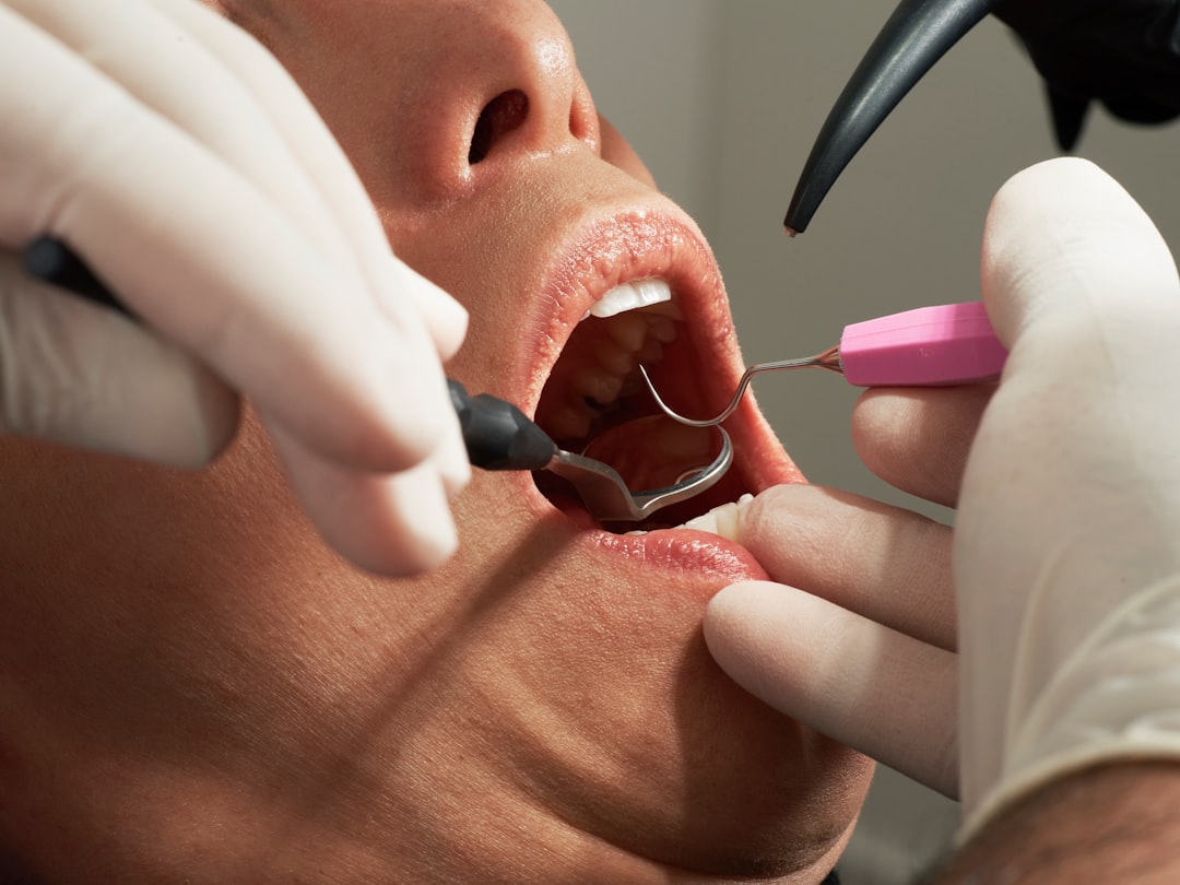 Close-up of a professional dental cleaning at New Dawn Dental Studio